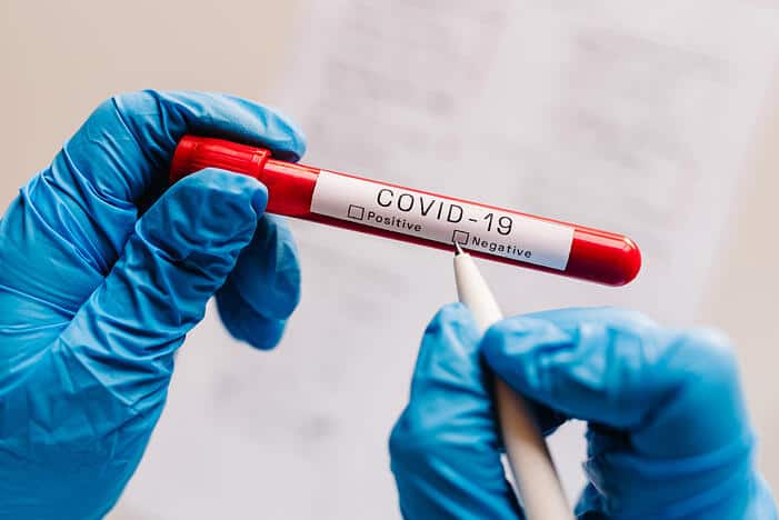COVID-19 test sample